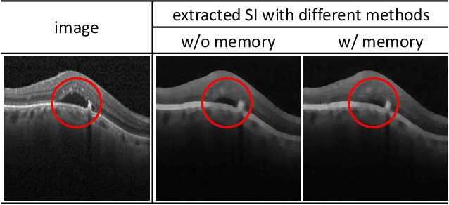 Figure 2 for Proxy-bridged Image Reconstruction Network for Anomaly Detection in Medical Images