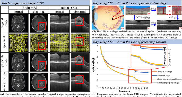 Figure 1 for Proxy-bridged Image Reconstruction Network for Anomaly Detection in Medical Images