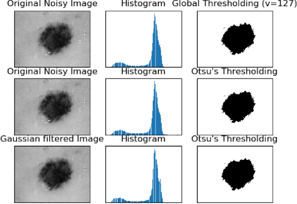 Figure 1 for Improving Lesion Detection by exploring bias on Skin Lesion dataset