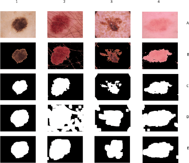 Figure 3 for Improving Lesion Detection by exploring bias on Skin Lesion dataset