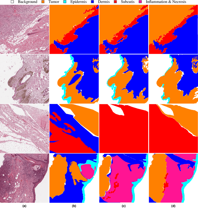 Figure 4 for Pan-Tumor CAnine cuTaneous Cancer Histology (CATCH) Dataset