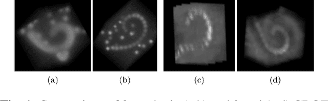 Figure 1 for Localization of Cochlear Implant Electrodes from Cone Beam Computed Tomography using Particle Belief Propagation