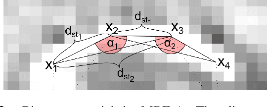 Figure 3 for Localization of Cochlear Implant Electrodes from Cone Beam Computed Tomography using Particle Belief Propagation