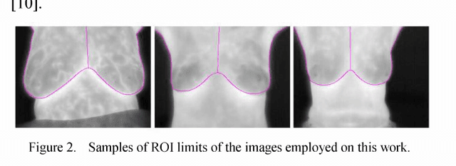 Figure 1 for Comparing Results of Thermographic Images Based Diagnosis for Breast Diseases