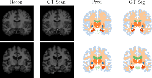 Figure 4 for An Auto-Encoder Strategy for Adaptive Image Segmentation