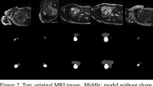 Figure 3 for SAUNet: Shape Attentive U-Net for Interpretable Medical Image Segmentation