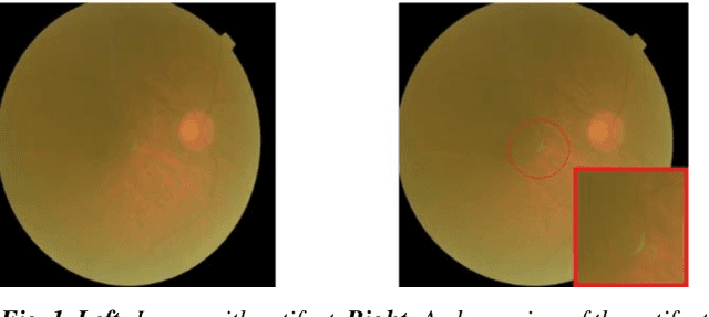 Figure 1 for Artifact Reduction in Fundus Imaging using Cycle Consistent Adversarial Neural Networks
