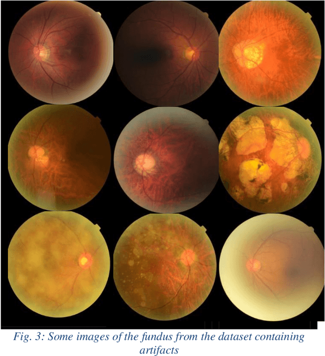 Figure 3 for Artifact Reduction in Fundus Imaging using Cycle Consistent Adversarial Neural Networks