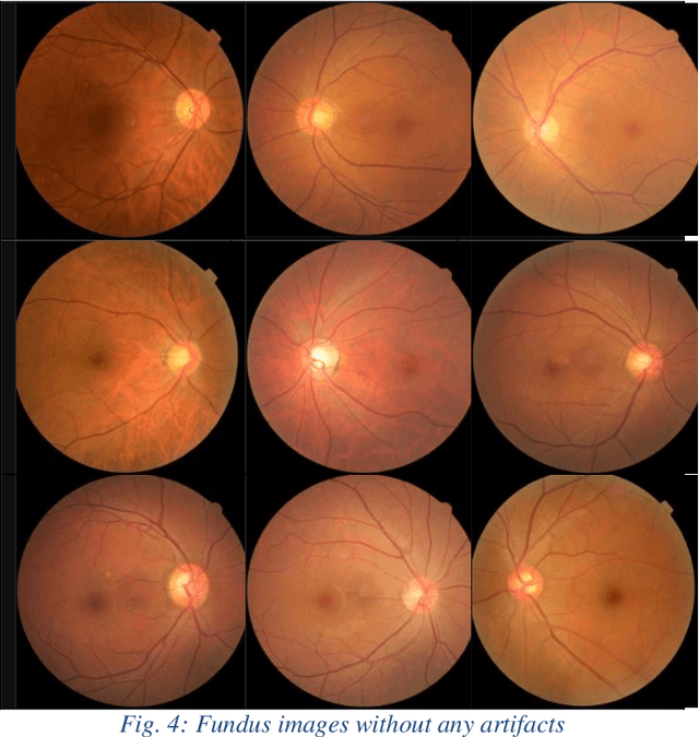 Figure 4 for Artifact Reduction in Fundus Imaging using Cycle Consistent Adversarial Neural Networks