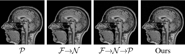 Figure 1 for A Theoretically Guaranteed Deep Optimization Framework for Robust Compressive Sensing MRI