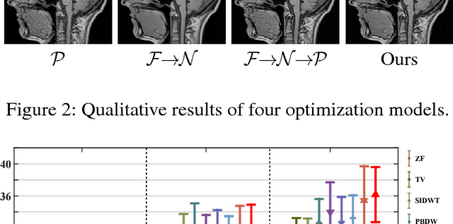 Figure 3 for A Theoretically Guaranteed Deep Optimization Framework for Robust Compressive Sensing MRI