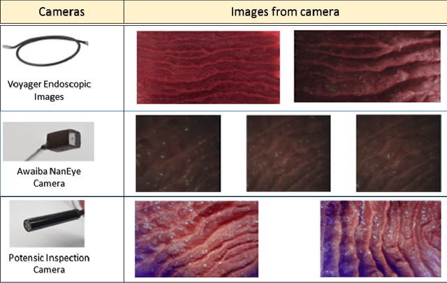 Figure 1 for A fully dense and globally consistent 3D map reconstruction approach for GI tract to enhance therapeutic relevance of the endoscopic capsule robot