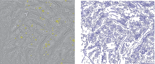 Figure 3 for Learning and Recognizing Archeological Features from LiDAR Data