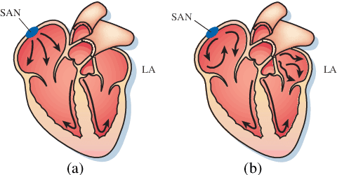 Figure 1 for Medical Image Analysis on Left Atrial LGE MRI for Atrial Fibrillation Studies: A Review