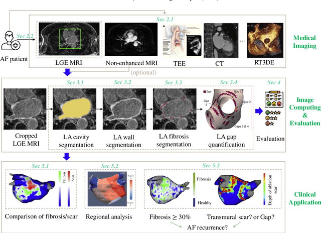 Figure 3 for Medical Image Analysis on Left Atrial LGE MRI for Atrial Fibrillation Studies: A Review