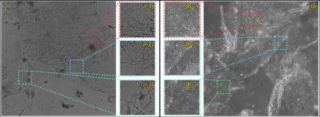 Figure 1 for Automated Onychomycosis Detection Using Deep Neural Networks