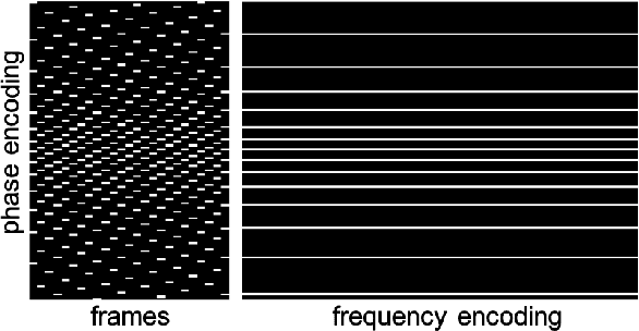 Figure 2 for Plug and play methods for magnetic resonance imaging