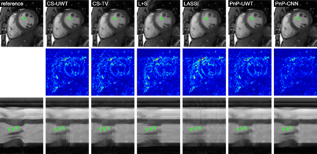 Figure 3 for Plug and play methods for magnetic resonance imaging