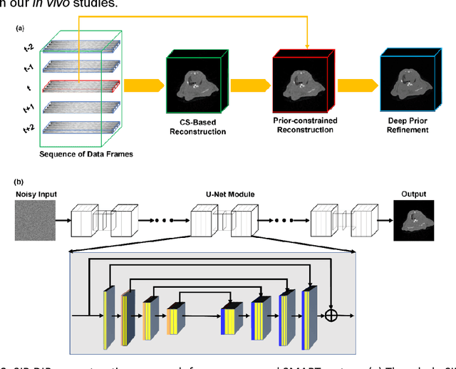 Figure 2 for Stationary Multi-source AI-powered Real-time Tomography (SMART) for Dynamic Cardiac Imaging