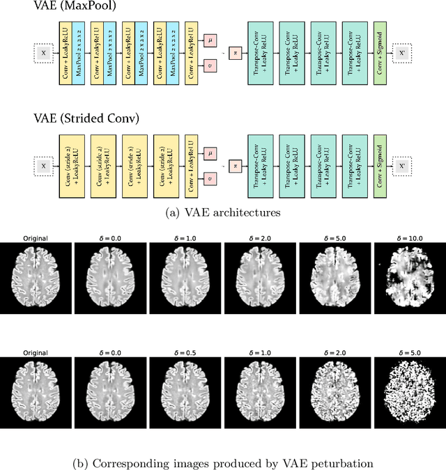 Figure 3 for Self-supervised Lesion Change Detection and Localisation in Longitudinal Multiple Sclerosis Brain Imaging