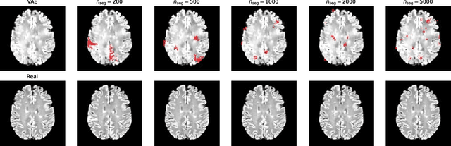 Figure 1 for Self-supervised Lesion Change Detection and Localisation in Longitudinal Multiple Sclerosis Brain Imaging