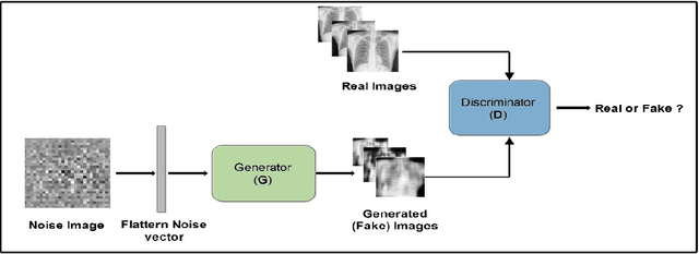 Figure 1 for Deep Learning Methods for Screening Pulmonary Tuberculosis Using Chest X-rays