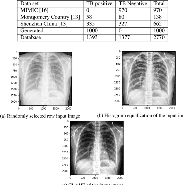 Figure 2 for Deep Learning Methods for Screening Pulmonary Tuberculosis Using Chest X-rays