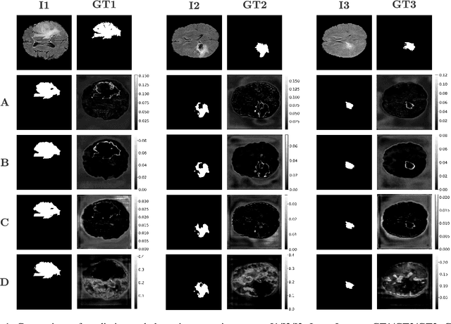 Figure 1 for Towards Reducing Aleatoric Uncertainty for Medical Imaging Tasks
