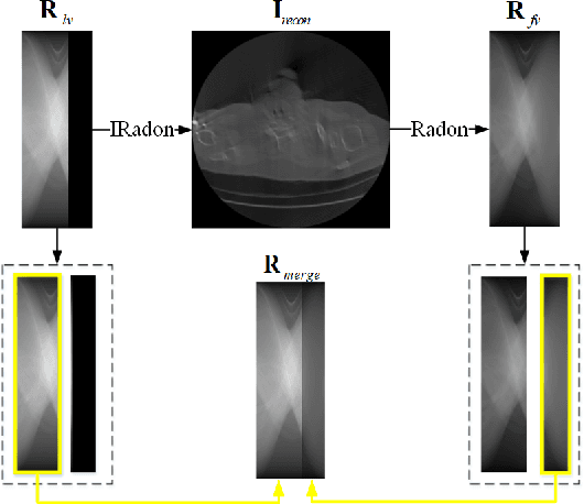 Figure 4 for Real-Time Limited-View CT Inpainting and Reconstruction with Dual Domain Based on Spatial Information