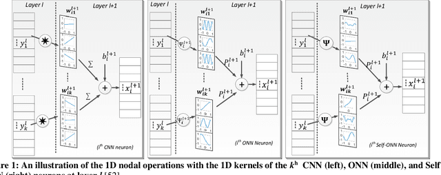 Figure 1 for Global ECG Classification by Self-Operational Neural Networks with Feature Injection