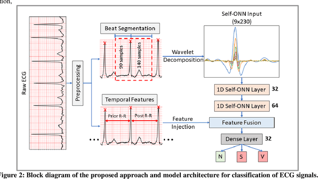 Figure 2 for Global ECG Classification by Self-Operational Neural Networks with Feature Injection