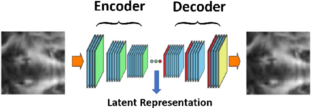 Figure 2 for A Deep Unsupervised Learning Approach Toward MTBI Identification Using Diffusion MRI