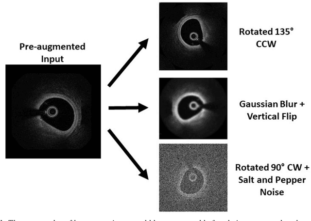 Figure 1 for Coronary Artery Segmentation from Intravascular Optical Coherence Tomography Using Deep Capsules