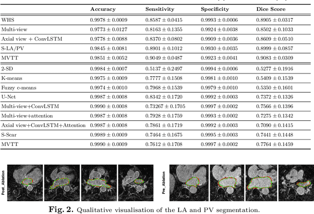 Figure 2 for Multiview Two-Task Recursive Attention Model for Left Atrium and Atrial Scars Segmentation