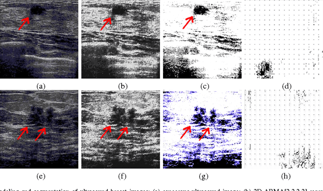 Figure 1 for Two-Dimensional ARMA Modeling for Breast Cancer Detection and Classification