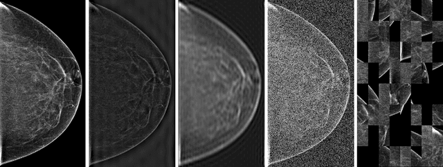 Figure 1 for Understanding the robustness of deep neural network classifiers for breast cancer screening