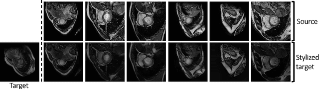Figure 2 for Few-shot Unsupervised Domain Adaptation for Multi-modal Cardiac Image Segmentation