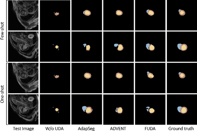 Figure 3 for Few-shot Unsupervised Domain Adaptation for Multi-modal Cardiac Image Segmentation