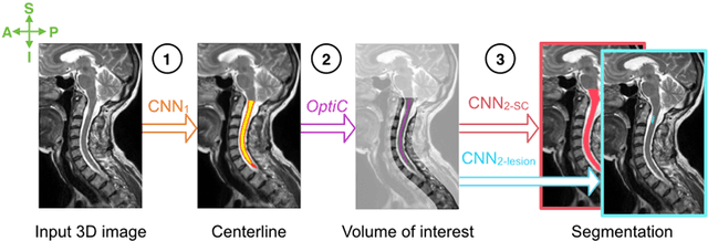 Figure 4 for Automatic segmentation of the spinal cord and intramedullary multiple sclerosis lesions with convolutional neural networks