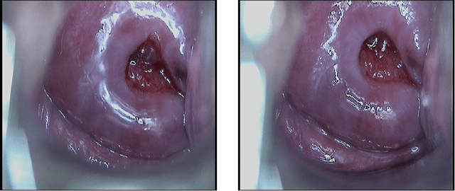 Figure 3 for Specular reflections removal in colposcopic images based on neural networks: Supervised training with no ground truth previous knowledge