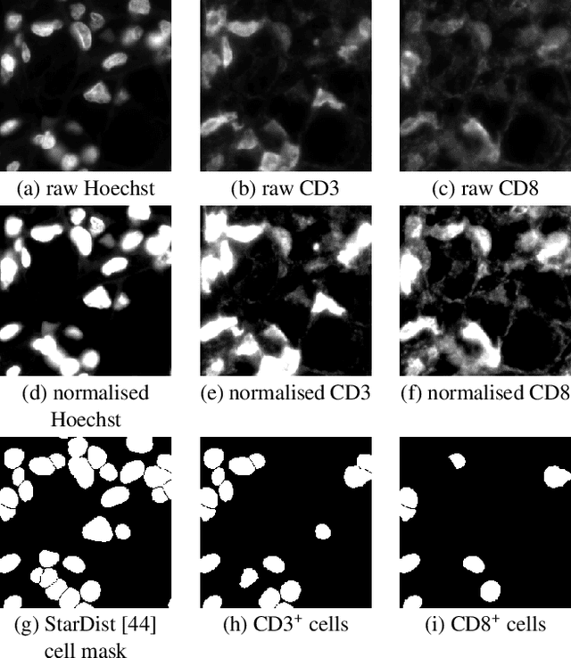 Figure 3 for HoechstGAN: Virtual Lymphocyte Staining Using Generative Adversarial Networks
