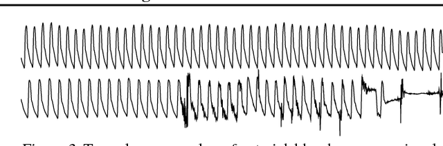 Figure 4 for Not to Cry Wolf: Distantly Supervised Multitask Learning in Critical Care