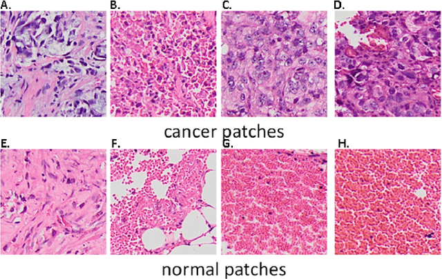 Figure 3 for Computer-aided diagnosis of lung carcinoma using deep learning - a pilot study