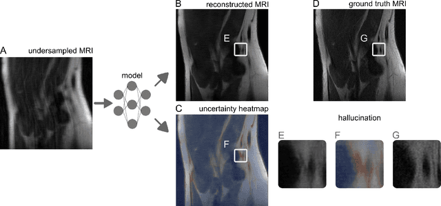 Figure 1 for Image-to-Image Regression with Distribution-Free Uncertainty Quantification and Applications in Imaging