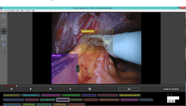 Figure 3 for The SARAS Endoscopic Surgeon Action Detection (ESAD) dataset: Challenges and methods