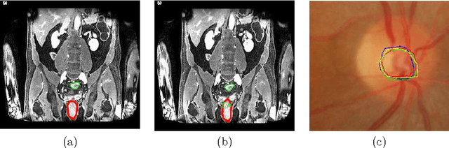 Figure 1 for Consensus Based Medical Image Segmentation Using Semi-Supervised Learning And Graph Cuts