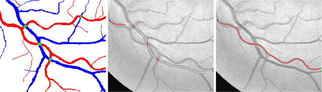 Figure 1 for A New Coherence-Penalized Minimal Path Model with Application to Retinal Vessel Centerline Delineation