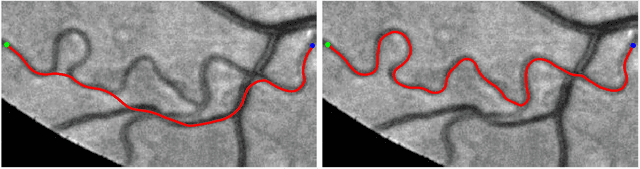 Figure 3 for A New Coherence-Penalized Minimal Path Model with Application to Retinal Vessel Centerline Delineation