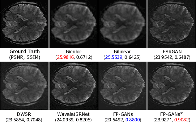 Figure 3 for Fine Perceptive GANs for Brain MR Image Super-Resolution in Wavelet Domain