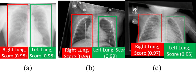 Figure 3 for Region Proposal Networks with Contextual Selective Attention for Real-Time Organ Detection